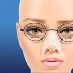 Nâng mũi có đeo kính được không? Nếu kiêng thì khoảng bao lâu?