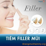 Nâng mũi không phẫu thuật bằng tiêm Filler mũi là gì?Chi phí bao nhiêu?