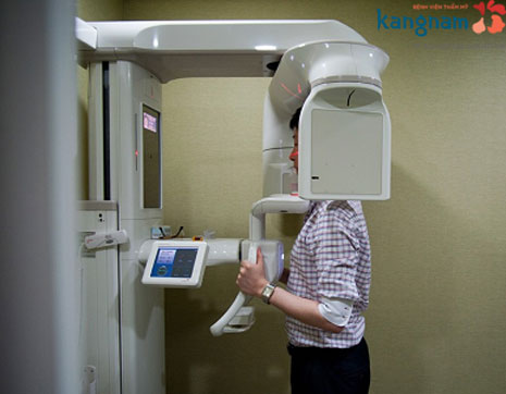 Quy trình nâng mũi tự thân