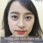 Sau khi nâng mũi nên làm gì? Cách chăm sóc sau nâng mũi khoa học nhất!