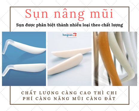 nâng sóng mũi bao nhiêu tiền