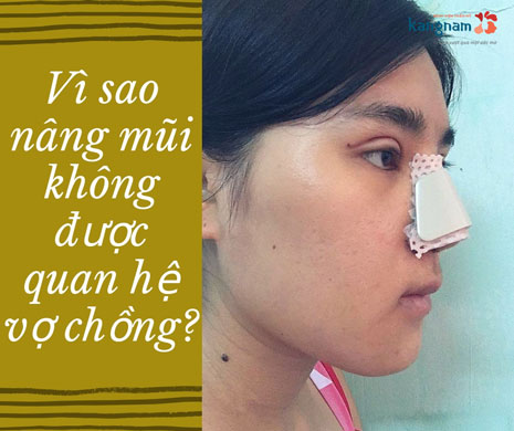 Tại sao nâng mũi không được quan hệ?