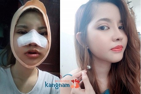 bệnh viện thẩm mỹ kangnam 8