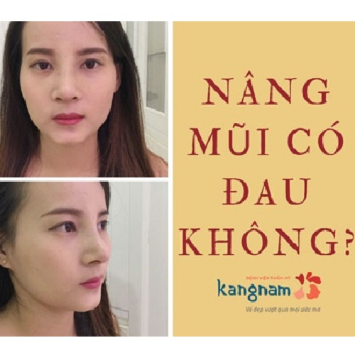 Phẫu thuật nâng mũi có đau không các mẹ? Bác sĩ và khách hàng chia sẻ!