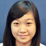 Mũi tẹt là như thế nào? Sống mũi thấp tẹt tướng số ra sao? Làm sao để mũi cao lên?