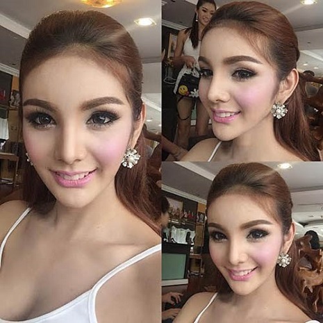 Nâng mũi Thái Lan tốt không? Chi phí phẫu thuật thẩm mỹ tại Thái Lan đắt không?