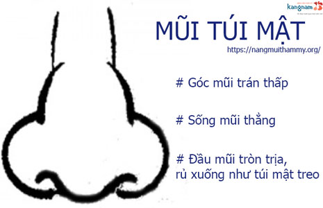 tướng mũi túi mật treo là gì