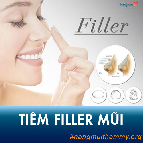Nâng mũi không phẫu thuật bằng tiêm Filler mũi là gì?Chi phí bao nhiêu?