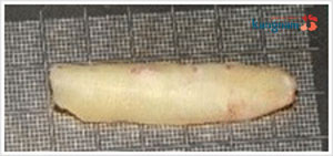 Sụn sườn lấy ở đâu