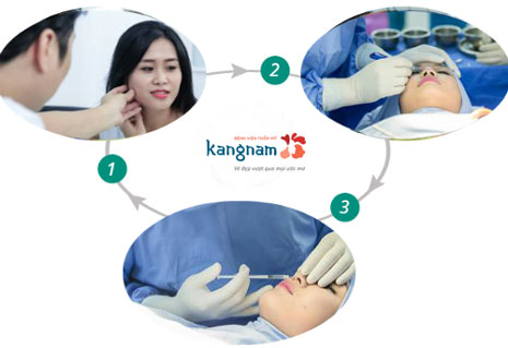 nâng mũi bằng Filler