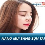 Nâng mũi bằng sụn tai có tốt không? Giá nâng mũi bọc sụn vành tai là bao nhiêu?