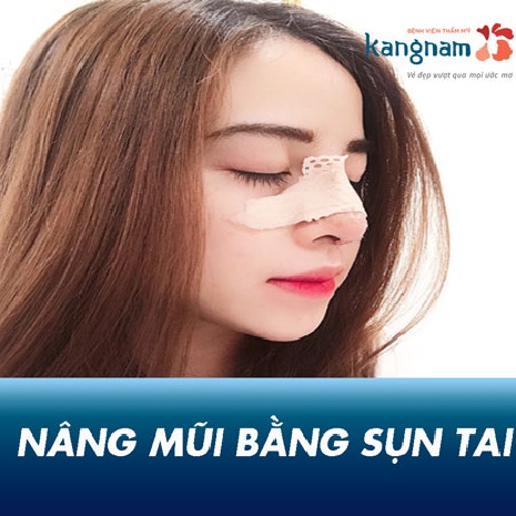 Nâng mũi bằng sụn tai có tốt không? Giá nâng mũi bọc sụn vành tai là bao nhiêu?