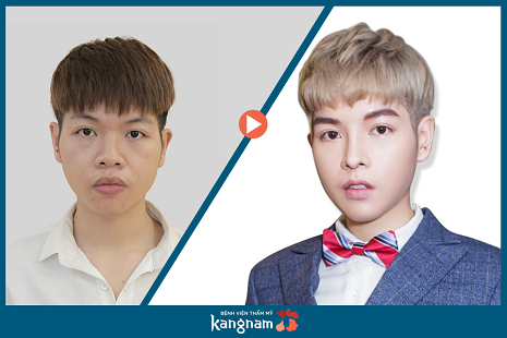 Khuyến mãi Kangnam