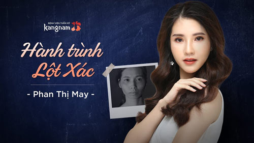 hành trình lột xác 2018 tập 2