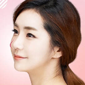 Phẫu thuật nâng mũi cấu trúc tại Kangnam