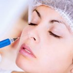 Chi phí tiêm Filler mũi giá bao nhiêu? Bảng giá tiêm Filler mũi tại Kangnam