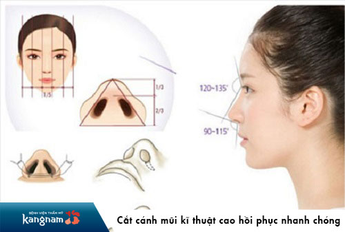 cắt cánh mũi bao lâu thì lành