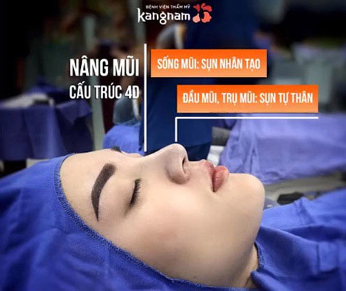 bệnh viện kangnam sài gòn