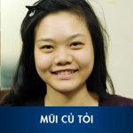 Dáng mũi củ tỏi như thế nào? Người mũi củ tỏi tướng số có tốt không??