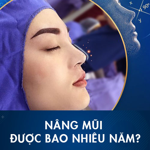Nâng mũi được bao nhiêu năm? 3 yếu tố ảnh hưởng đến kết quả