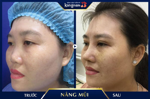 hướng dẫn cách trang điểm mũi cao