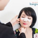 Nâng mũi bao lâu thì Gom lại? Làm gì để mũi nhanh gộp hơn?