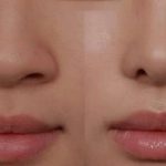 Đàn ông, phụ nữ đầu mũi to tướng số Tốt hay Xấu? Khắc phục ra sao?