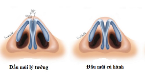 đầu mũi to là gì