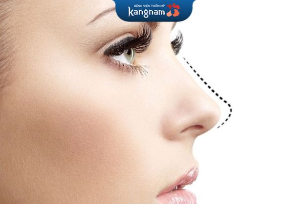 Nâng mũi 6D không đau tại Kangnam có mức giá 49 triệu đồng