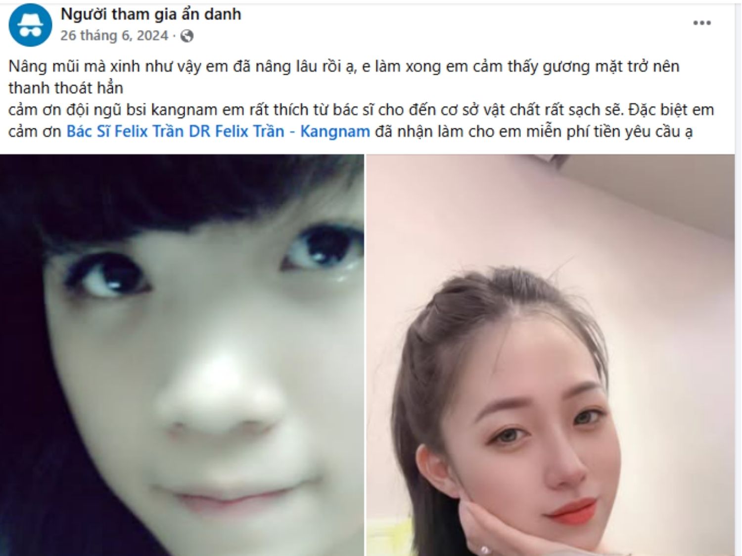 Trải nghiệm khách hàng thật làm đẹp tại kangnam